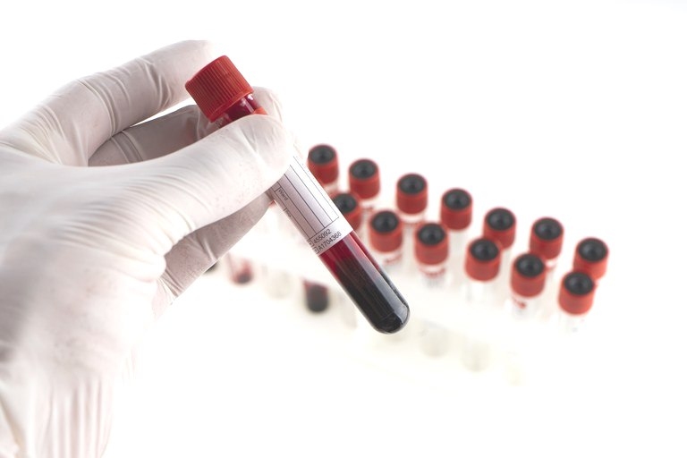 Planos de Saúde deverão oferecer testes grátis de covid-19