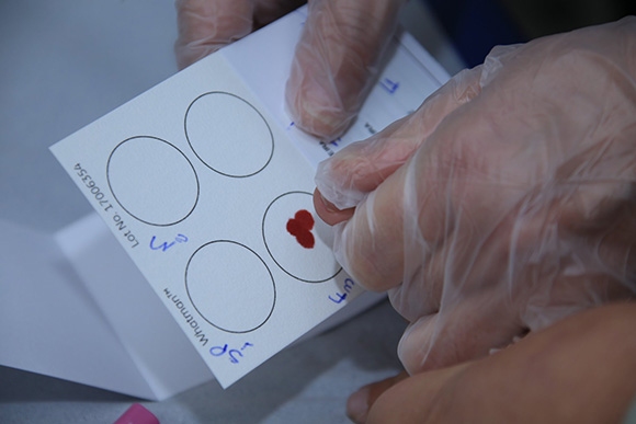 Santana de Parnaíba terá exame de DNA na rede pública