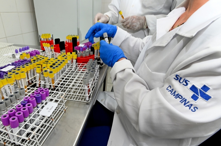 Modernização vai ampliar a capacidade do Laboratório Municipal em 1 milhão de exames